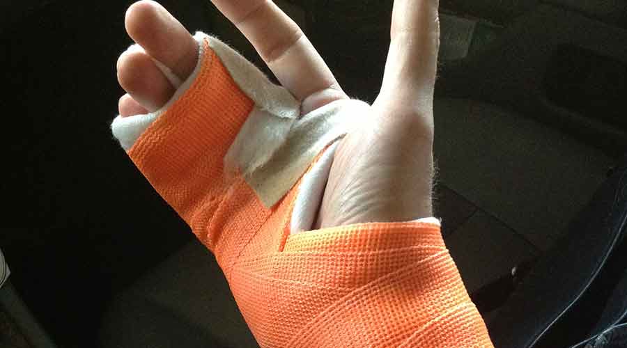 Repetitive closing of circuit breakers can be hazardous to your health